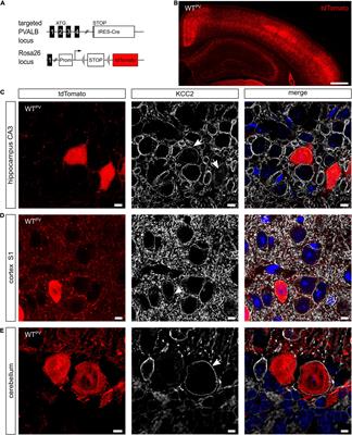 Disruption of KCC2 in Parvalbumin-Positive Interneurons Is Associated With a Decreased Seizure Threshold and a Progressive Loss of Parvalbumin-Positive Interneurons